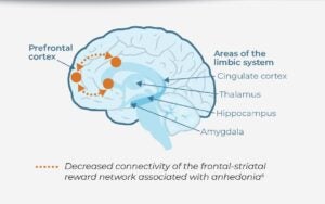 Understanding Neuroplasticity In Depression